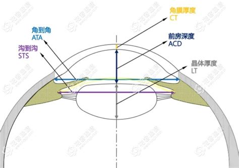 拱高|刘保松博士谈ICL晶体植入⑲： 破解拱高焦虑